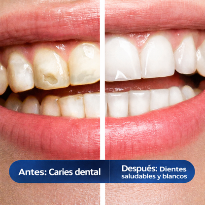 Dental Cavity Healing: Blanquea, sana caries y fortalece tus dientes
